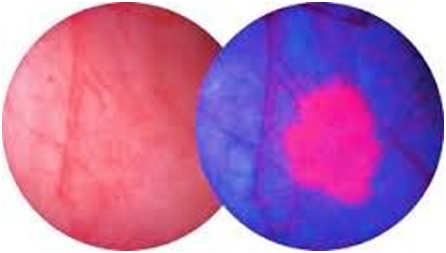 pech.jpg.9525ca6a2fab61d448d030b0600fc80